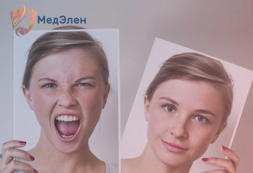 Девушка с биполярным расстройством